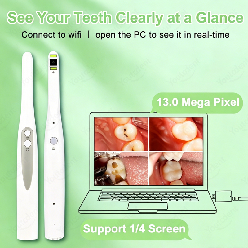 Kamera Intraoral Gigi WIFI Nir - Endoscope Inspection Camera ulasan dan harga